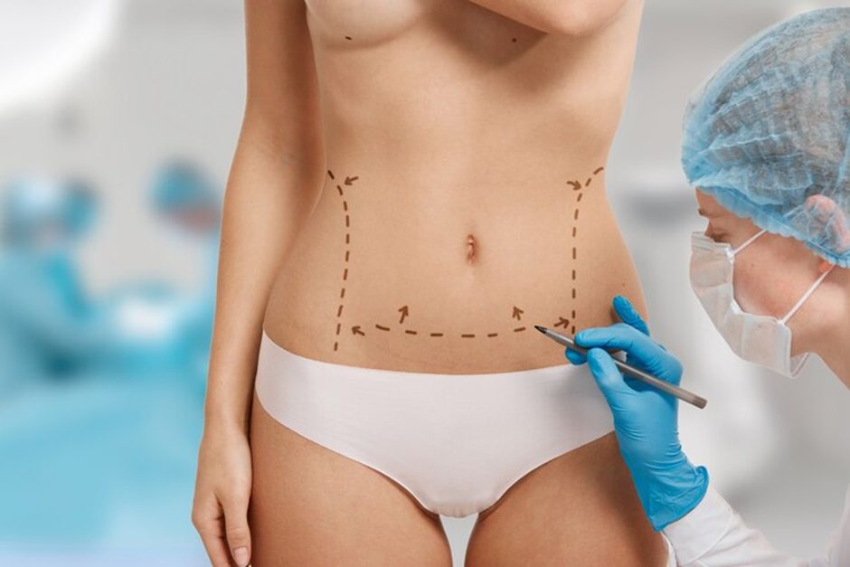 What Is Body Contouring and Its Other Aspects?